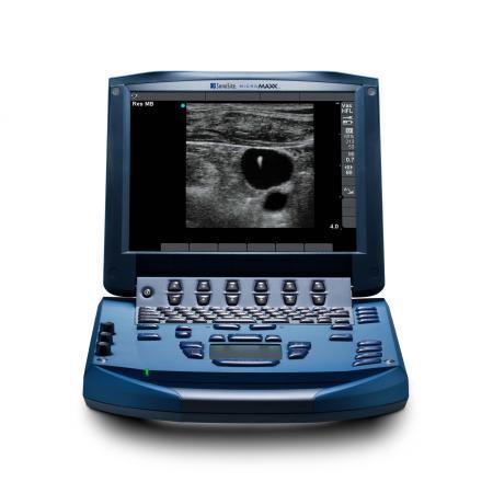 SonoSite MicroMaxx Ultrasound - Image 4