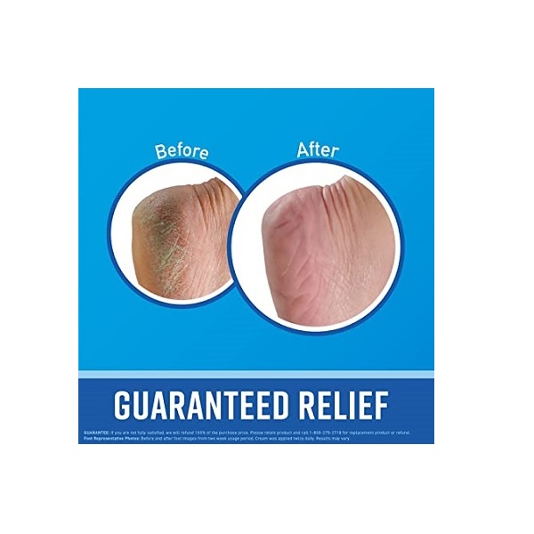 12 - Pack O'Keeffe's K0320001-12 Healthy Feet Foot Cream in Jar (12 Pack), 3.2 oz - Image 2