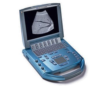 SonoSite MicroMaxx Ultrasound - Image 5