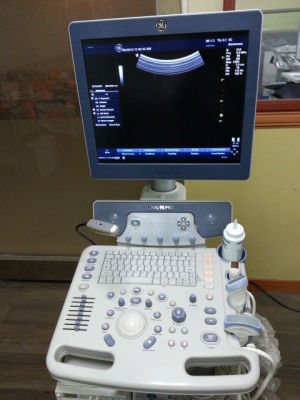 LOGIQ P6 Ultrasound System - Image 2