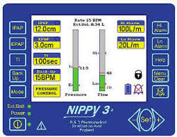 Nippy 3 Portable Respiratory Ventilator - Image 2