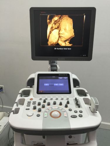 Samsung Accuvix XG Ultrasound - Image 4