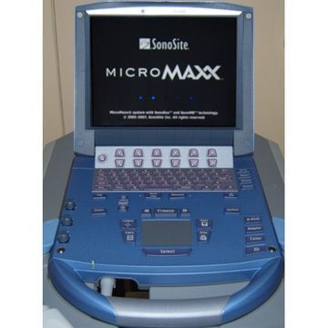 SonoSite MicroMaxx Ultrasound - Image 2
