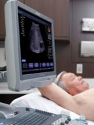 Siemens ACUSON X300 Ultrasound System - Image 4