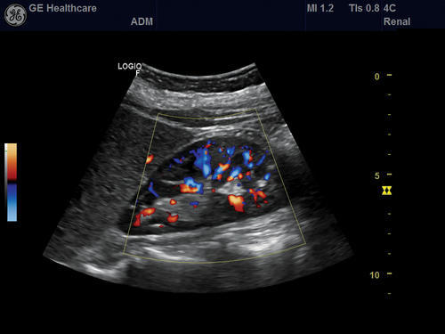 GE Volusion G8 Ultrasound - Image 2