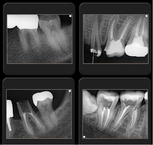 Genoray Portable X-ray Port XII - Image 3