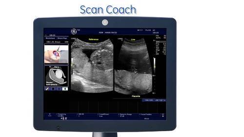 LOGIQ P6 Ultrasound System - Image 3