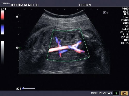 Toshiba Nemio XG Ultrasound Machine - Image 5
