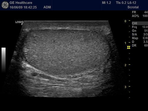GE Volusion G8 Ultrasound - Image 4