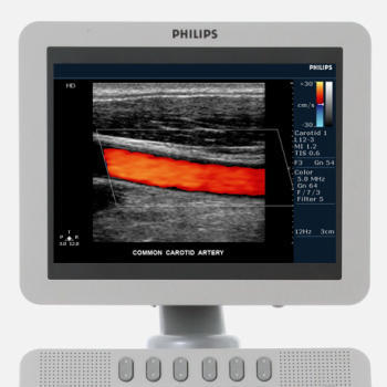 Philips HD7 Ultrasound Machine - Image 2
