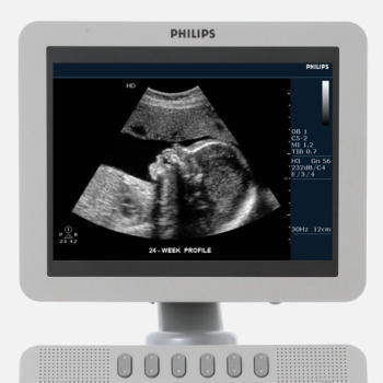 Philips HD7 Ultrasound Machine - Image 4