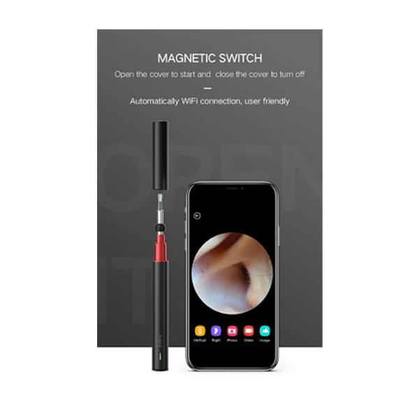 A2 - High Precision Otoscope