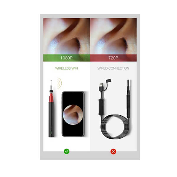 A2 - High Precision Otoscope - Image 11