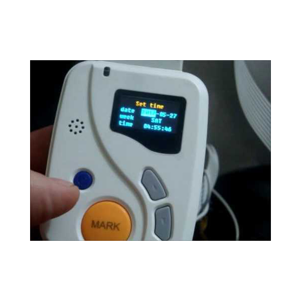 CONTEC TLC 6000 Holter Monitor - Image 2