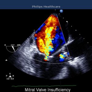 Philips CX50 Ultrasound Machine -