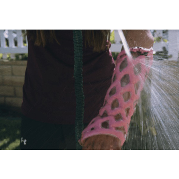 Cast 21 - Innovative casting and bracing - Image 4