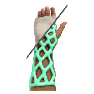 Cast 21 - Innovative casting and bracing