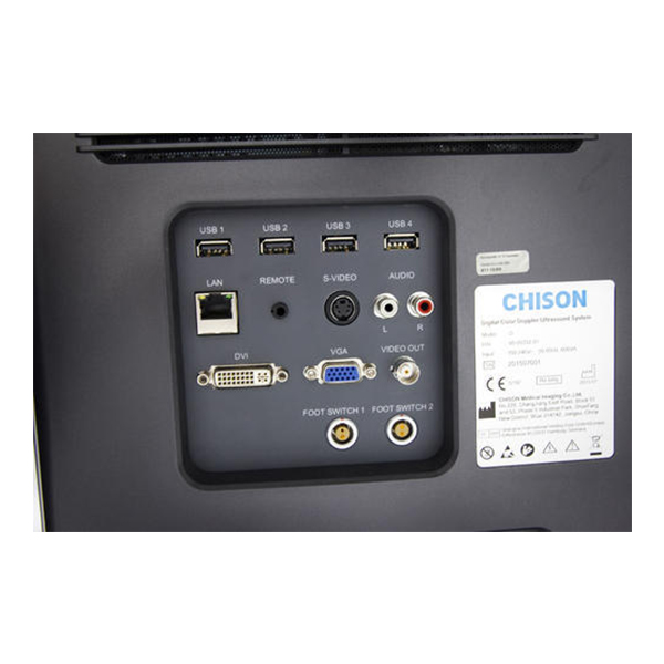 Chison Q Bit 5 Color Doppler System - Image 4