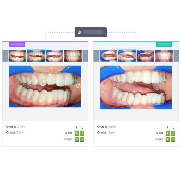 Dental Monitoring