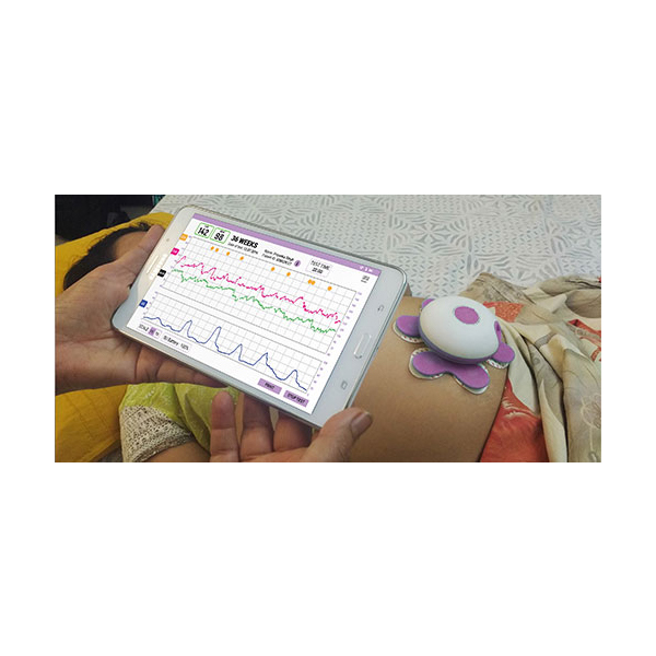 Fetal Lite - AI-powered, fetal heart rate (FHR) monitor - Image 2