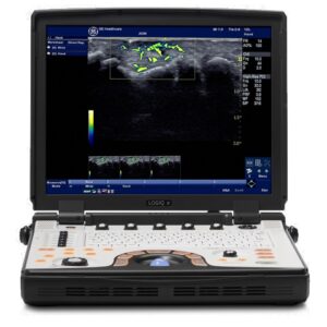 GE LOGIQ e R7 Ultrasound