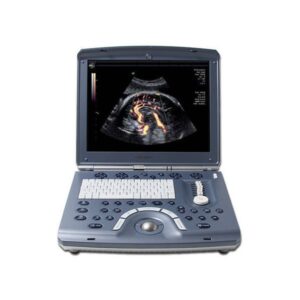 GE Voluson e Ultrasound