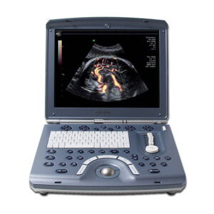 GE Voluson e Ultrasound Machine -