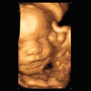 GE Logiq E9 Ultrasound Machine -