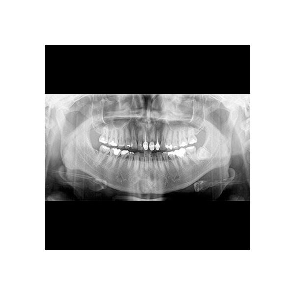 Genoray Papaya 3D Plus CBCT with Ceph - Image 3