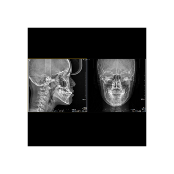 Genoray Papaya 3D Plus CBCT with Ceph - Image 4