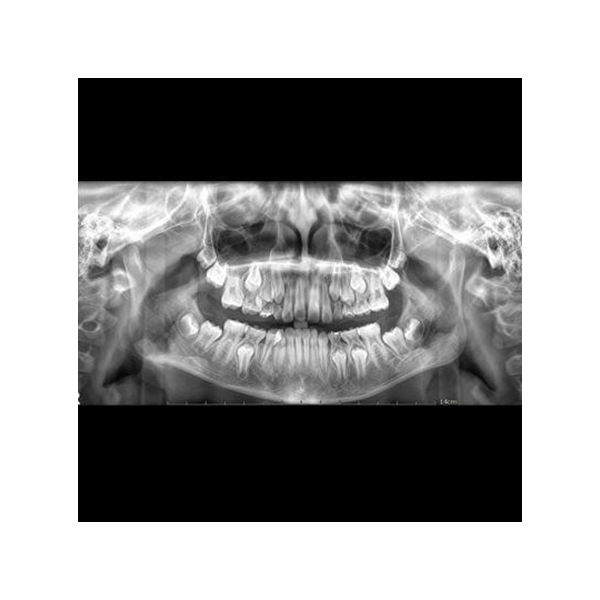 Genoray Papaya 3D Plus CBCT with Ceph - Image 5