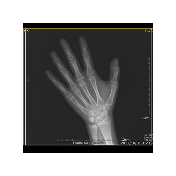 Genoray Papaya 3D Plus CBCT with Ceph - Image 6