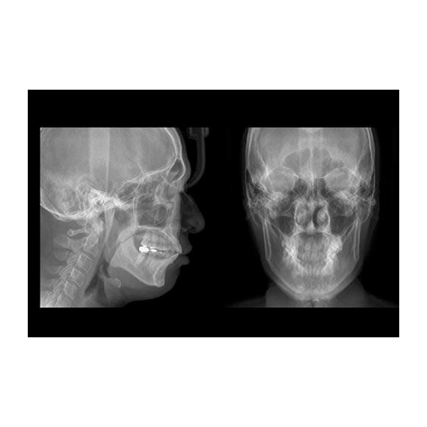 Genoray Papaya OPG Machine - Image 7