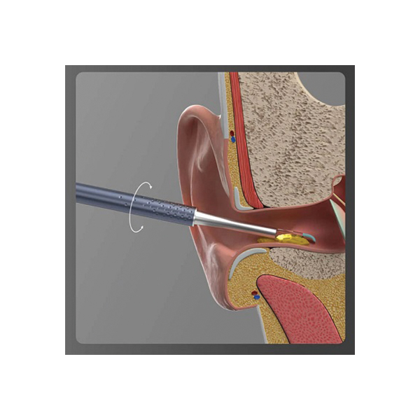 BEBIRD K10 - Safer and Comfortable Gyroscope Wired Otoscope - Image 2