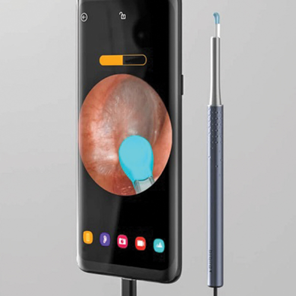 BEBIRD K10 - Safer and Comfortable Gyroscope Wired Otoscope - Image 4