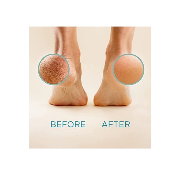 Lee Beauty Professional Best Callus Remover. Callus Eliminator, Liquid & Gel For Corn And Callus On Feet. Professional Grade - Image 7
