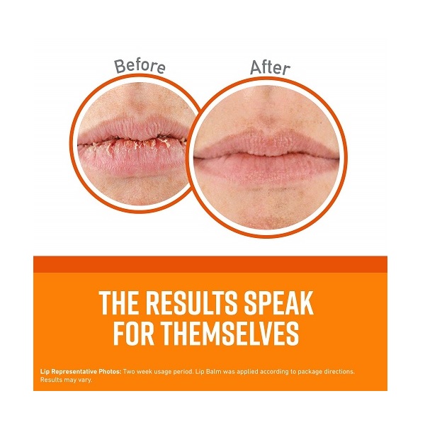 O'Keeffe's Original Lip Repair Lip Balm for Dry, Cracked Lips, Stick, (Pack of 3) - Image 2