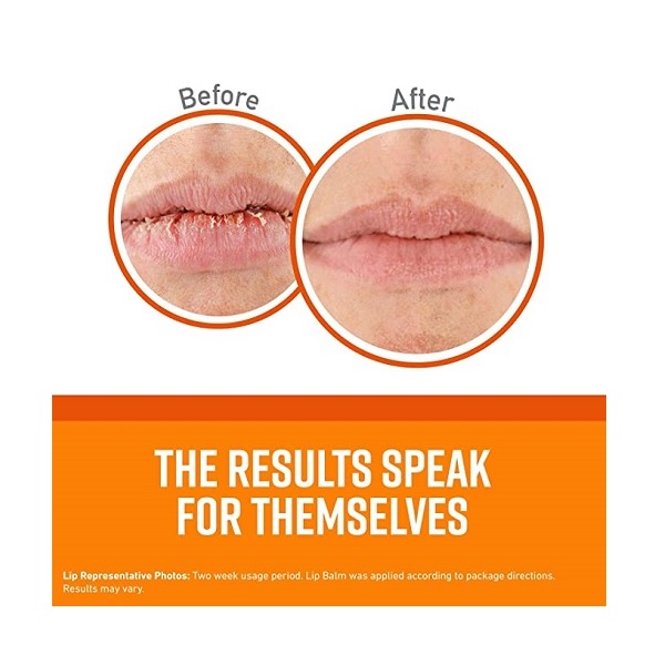 O'Keeffe's Unscented Lip Repair Lip Balm for Dry, Cracked Lips, Stick - Image 3