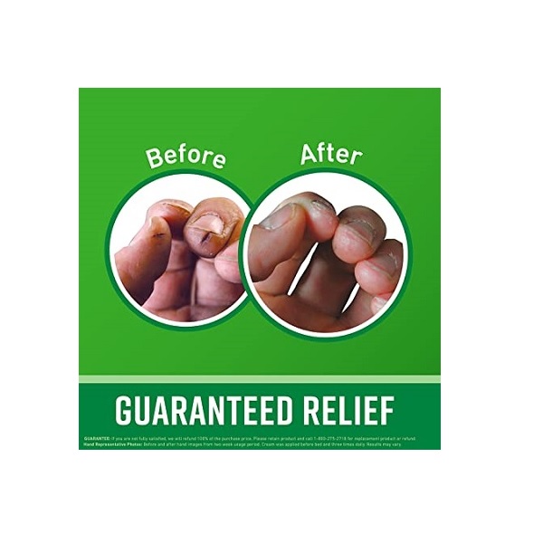 O'Keeffe's Working Hands Hand Cream - Image 3