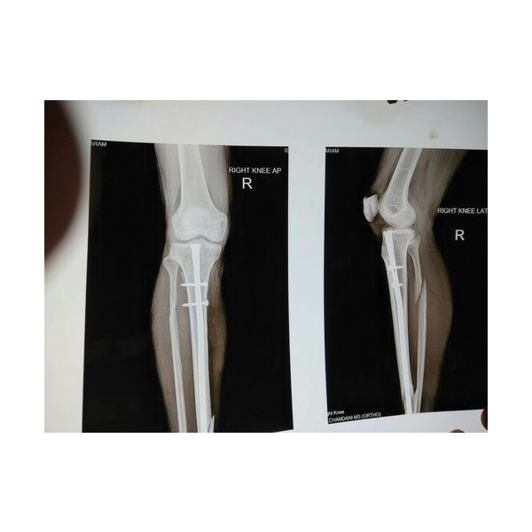 Orvee Medical X-Ray Machine - Image 4