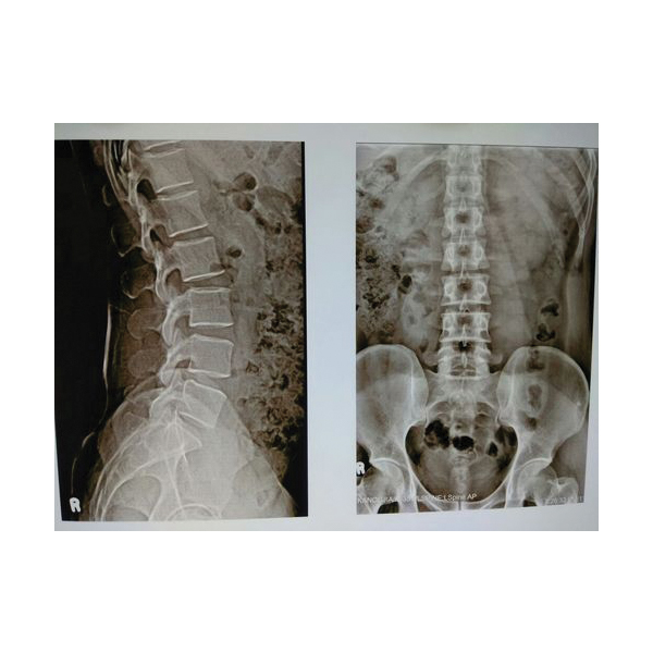 Orvee Medical X-Ray Machine - Image 5