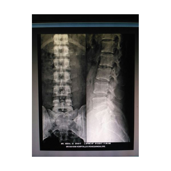 Orvee Medical X-Ray Machine - Image 6