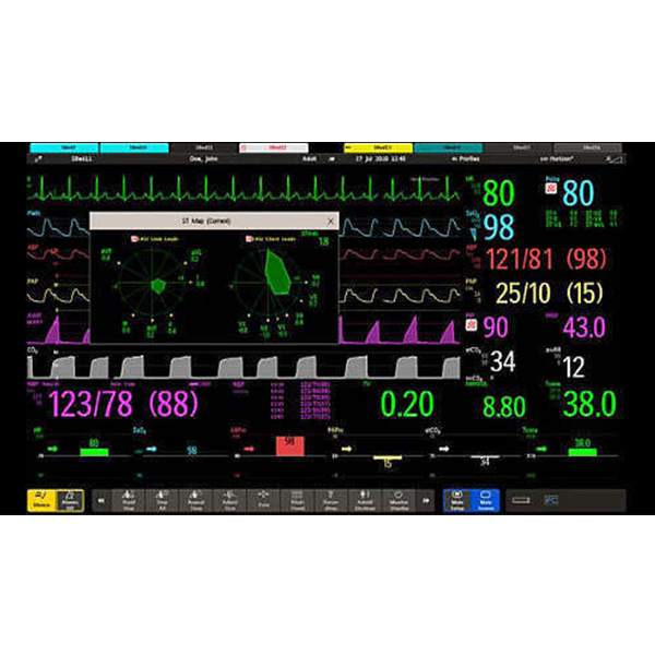 Philips IntelliVue Patient Monitors - Image 4