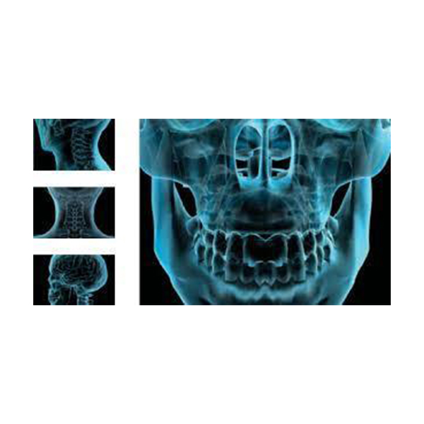 Planmeca PROMAX 3D Cone Beam CT Digital Dental Panoramic X-ray System - Image 4