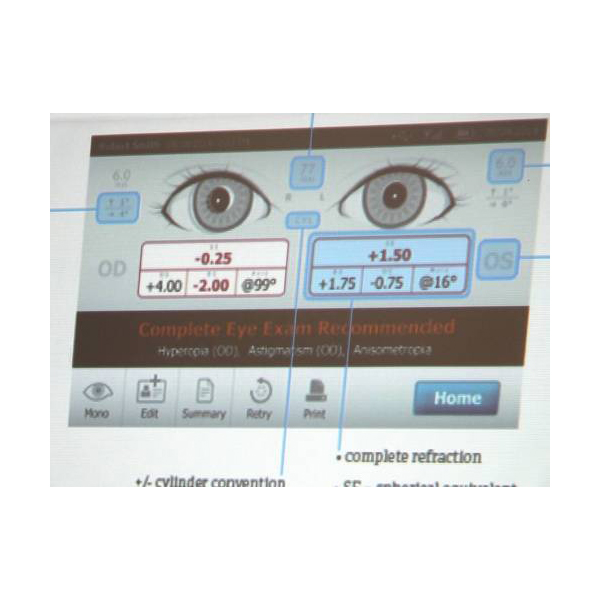Plusoptix Vision Screen Equipment - Image 5