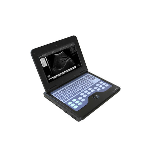Portable Ultrasound Diagnostic System