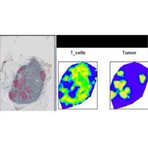 Precision Pathology