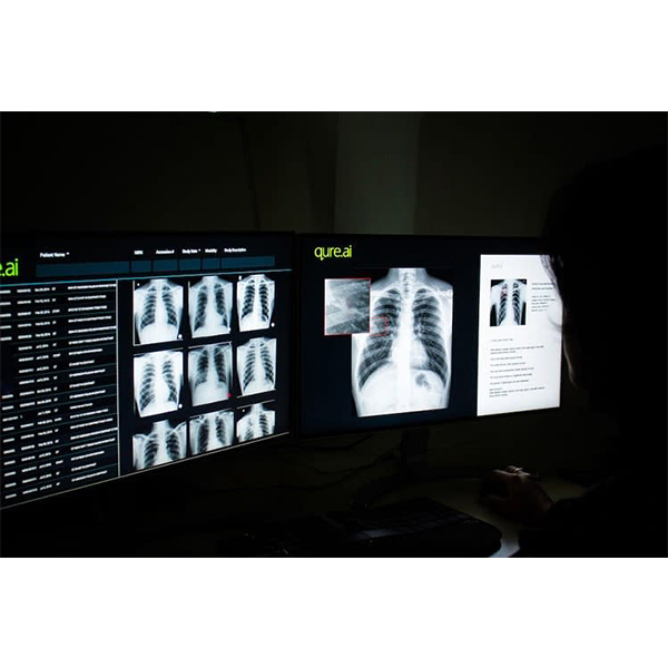 qXR - TB Screening