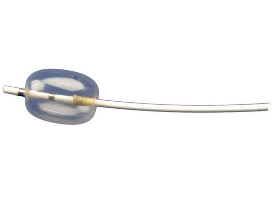 STONE EXTRACTION BALLOON
