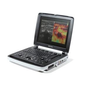 Samsung UGEO HM70A Ultrasound Machine -